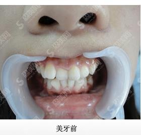 桂林医学院附属医院口腔科价格表查询，牙齿矫正使我拥有灿烂笑容！