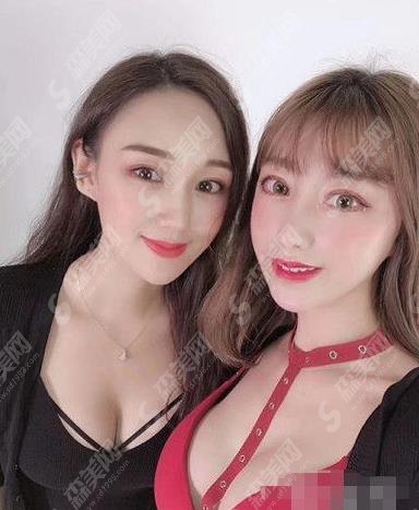 郑州大学第一附属医院整形科价格表2021，假体隆胸果可以吗？