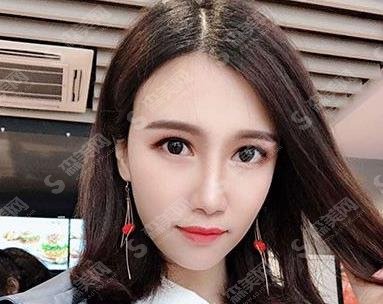 北京雍禾医院植发靠谱吗？医院简介及植发案例分享