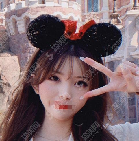 武汉同济医院整形科双眼皮多少钱，让每个爱美的你都能负担得起