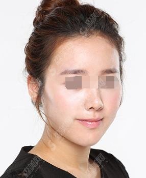 王阳医生怎么样？北京协和/整形案例简直惊艳广大网友！