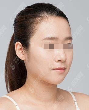 王阳医生怎么样？北京协和/整形案例简直惊艳广大网友！